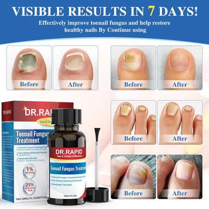 DR.RAPID Toenail Fungus Treatment Extra Strength - Fast-Acting Nail Repair with Tea Tree Oil