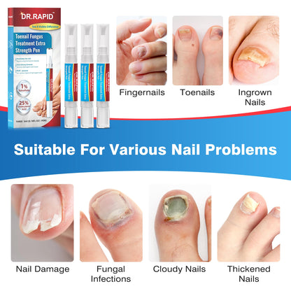 DR.RAPID Toenail Fungi Treatment Extra Strength Nail Pen – 3x 5ml