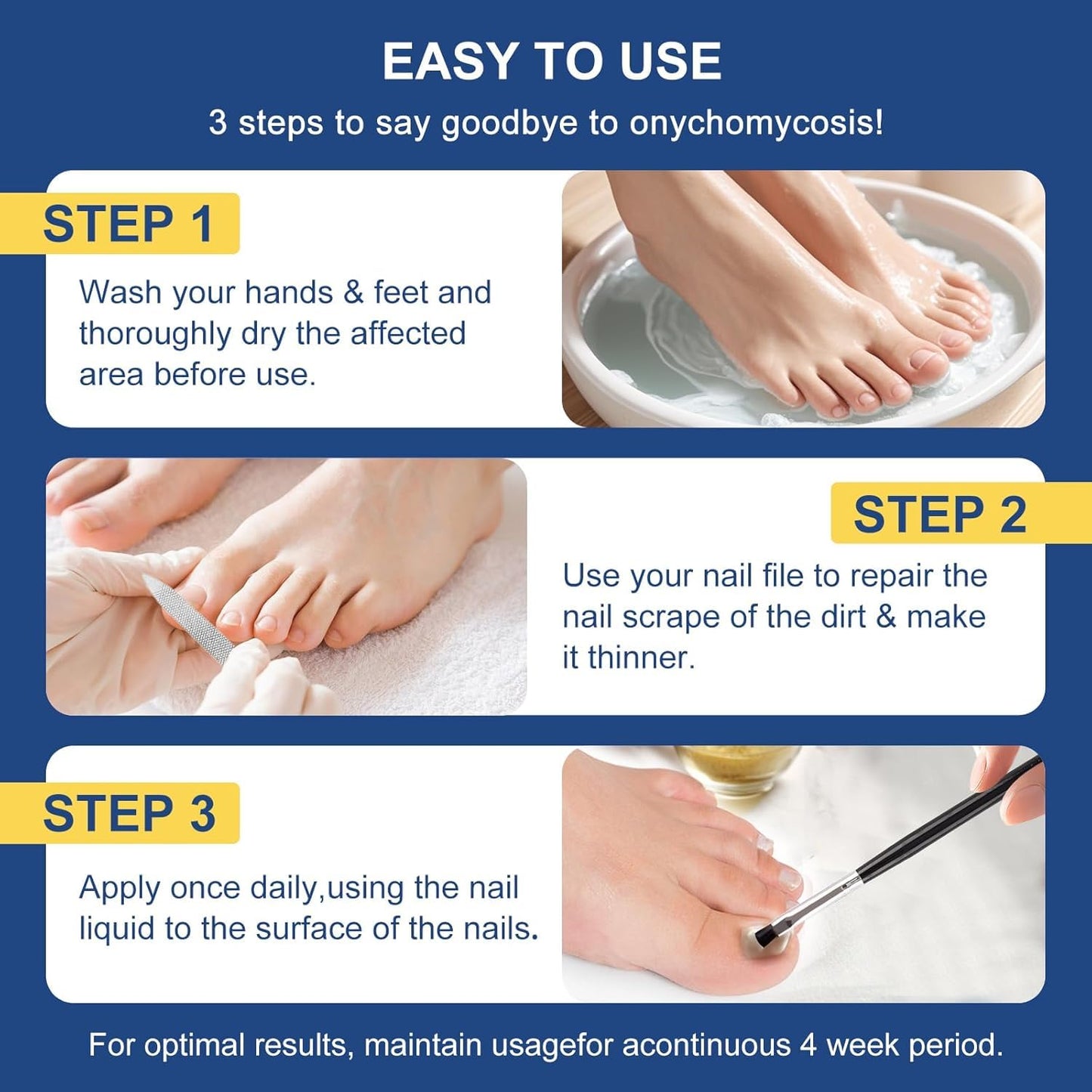 Drawzone Toenail Fungus Treatment Extra Strength – 25% Undecylenic Acid, Nail Renewal