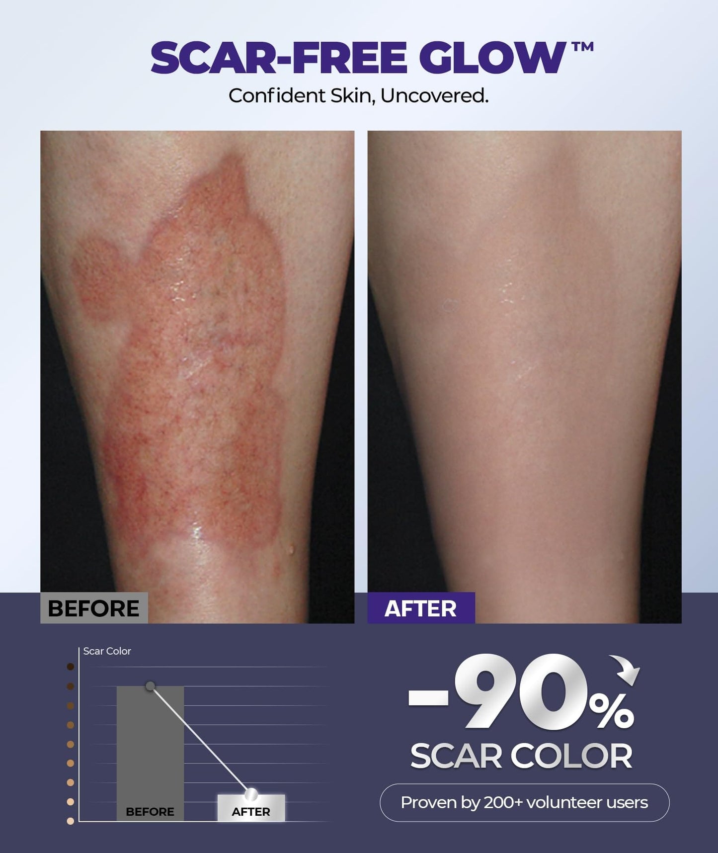 EASEWAVE Silicone Scar Cream – 6.7% Active, Visible in 2 Weeks (55ML)