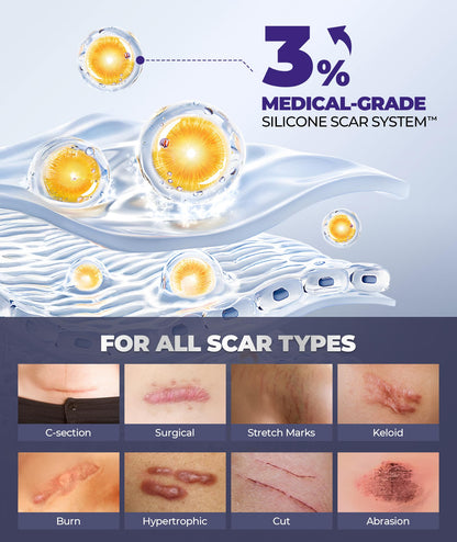 EASEWAVE Silicone Scar Cream – 6.7% Active, Visible in 2 Weeks (55ML)