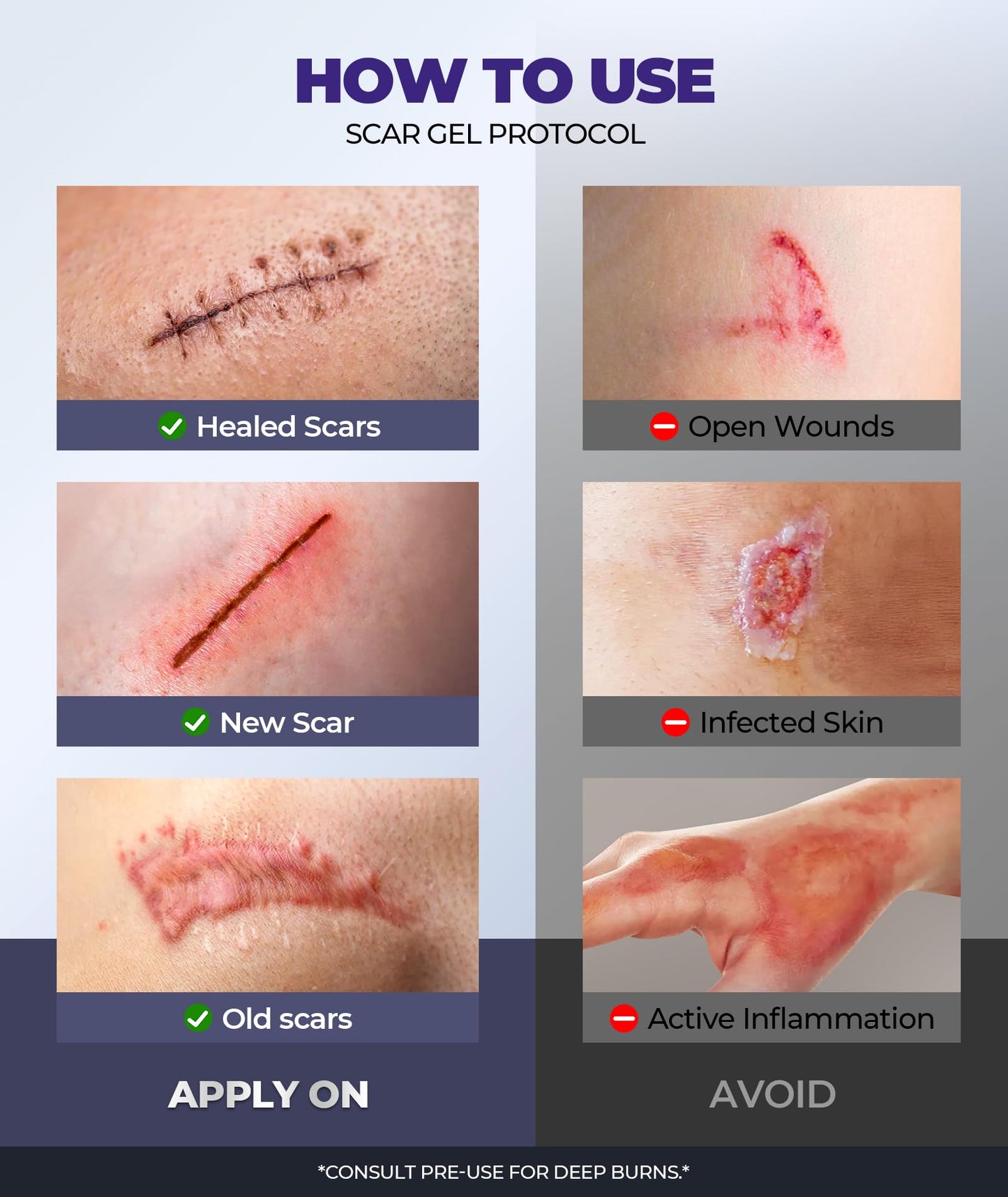 EASEWAVE Silicone Scar Cream – 6.7% Active, Visible in 2 Weeks (55ML)