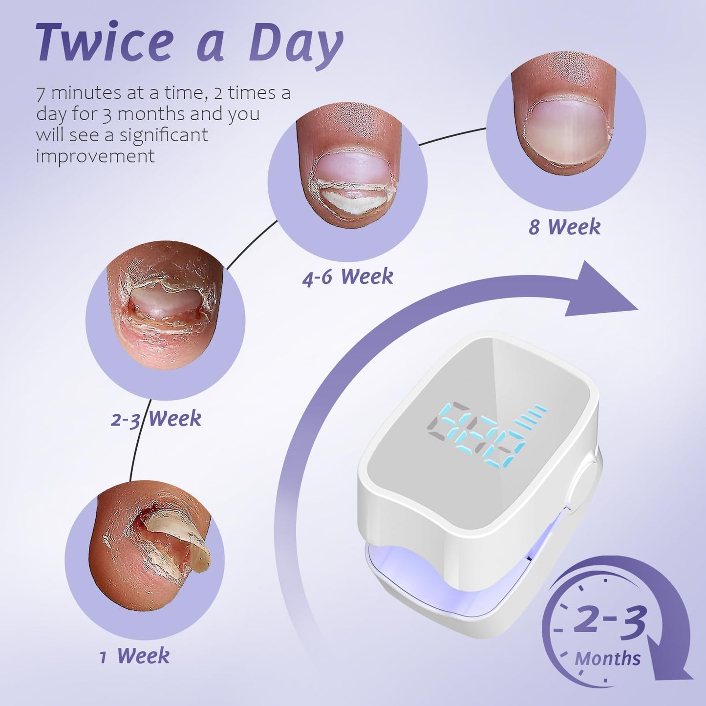 easheal Nail Fungus Laser Treatment – Home LED Nail Therapy for Thick Toenails