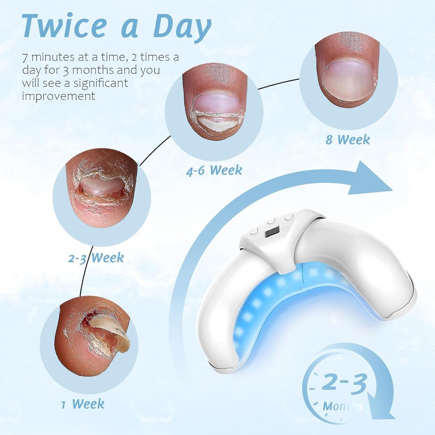 Easheal Nail Fungus LED Device – At-Home Toenail Fungus Treatment for Weak and Damaged Nails