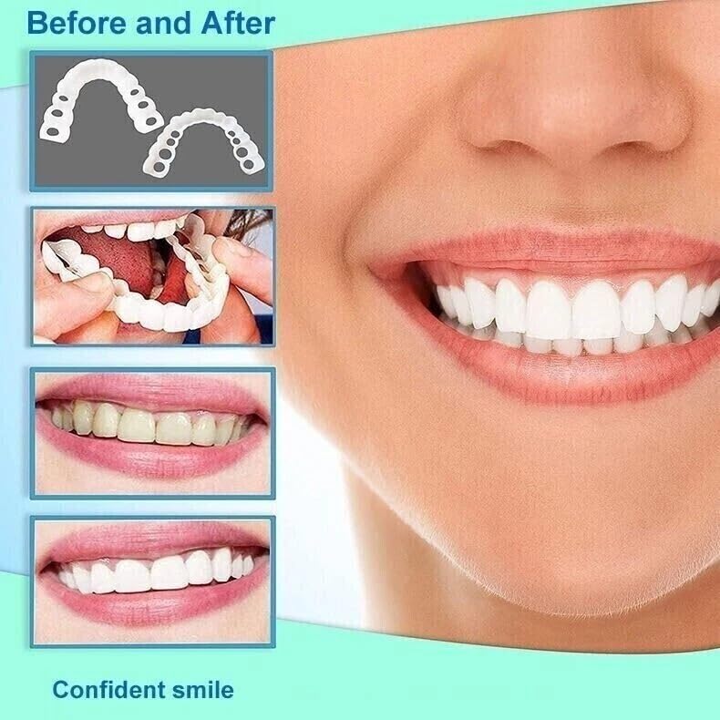 2 Pairs Natural-Looking Temporary Smile Solutions – Top & Bottom Adjustable, Comfortable Experience