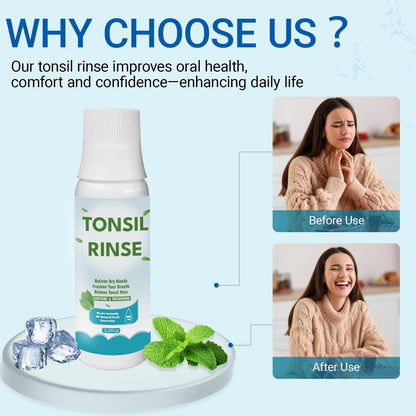 Tonsil Stone Mouthwash – Natural Oral Rinse for Bad Breath & Dry Mouth (100 ml)