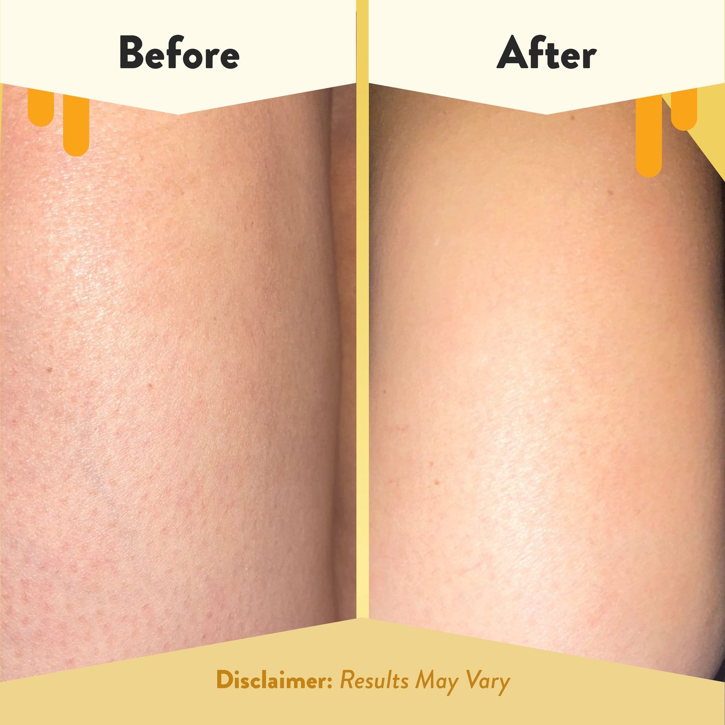 ECZEMA HONEY Soothing Body Wash — Gentle Eczema & Sensitive Skin Shower Gel (13 Oz)
