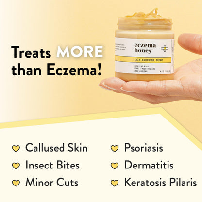 ECZEMA HONEY Original Skin-Soothing Cream – Organic Eczema Relief for Dry, Itchy Skin (4 oz)