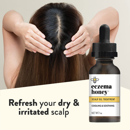 ECZEMA HONEY Soothing Scalp Oil – Natural Honey Hair Care for Itchy, Dry Scalp