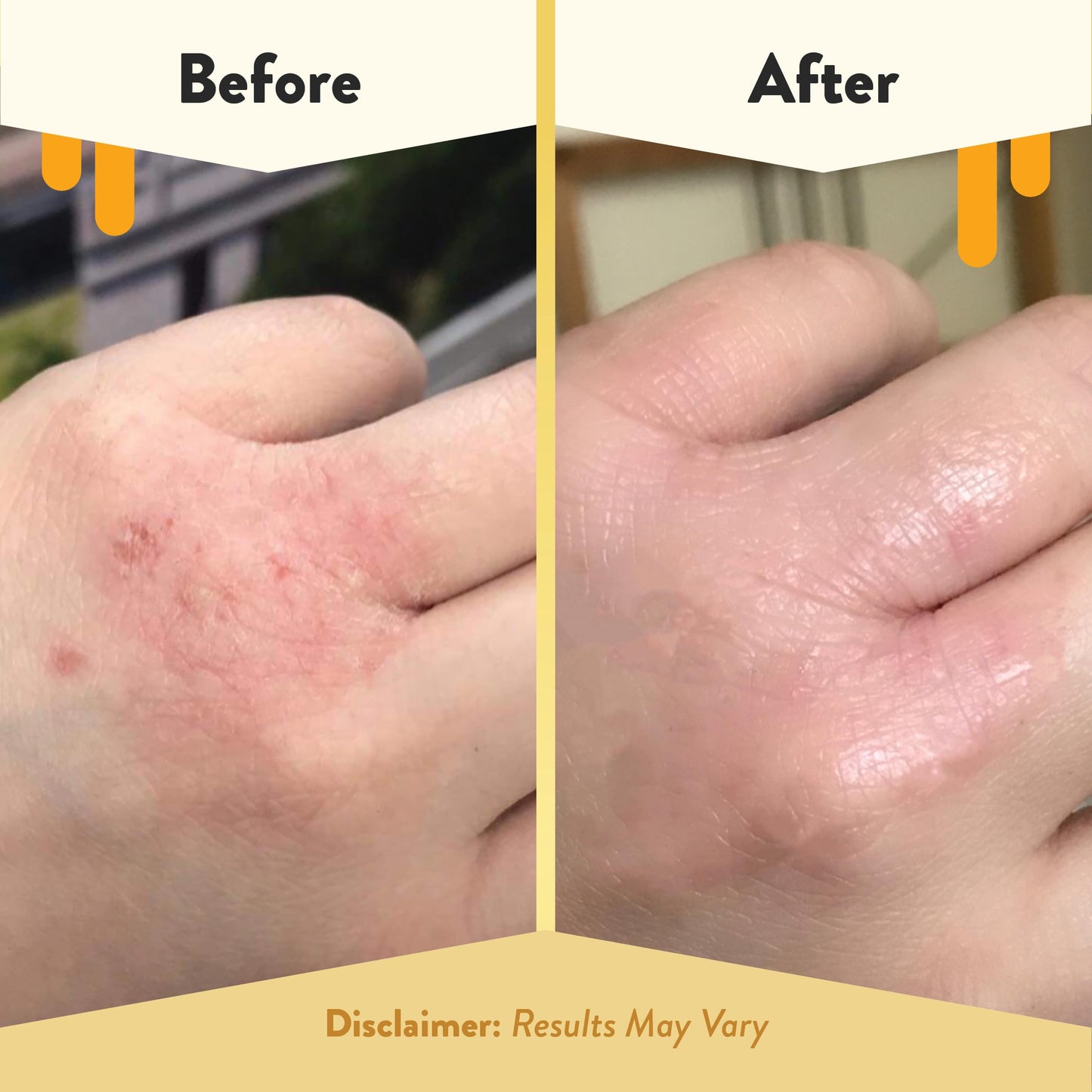 ECZEMA HONEY Original Skin-Soothing Cream – Organic Eczema Relief for Dry, Itchy Skin (4 oz)