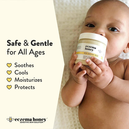 ECZEMA HONEY Original Skin-Soothing Cream – Organic Eczema Relief for Dry, Itchy Skin (4 oz)