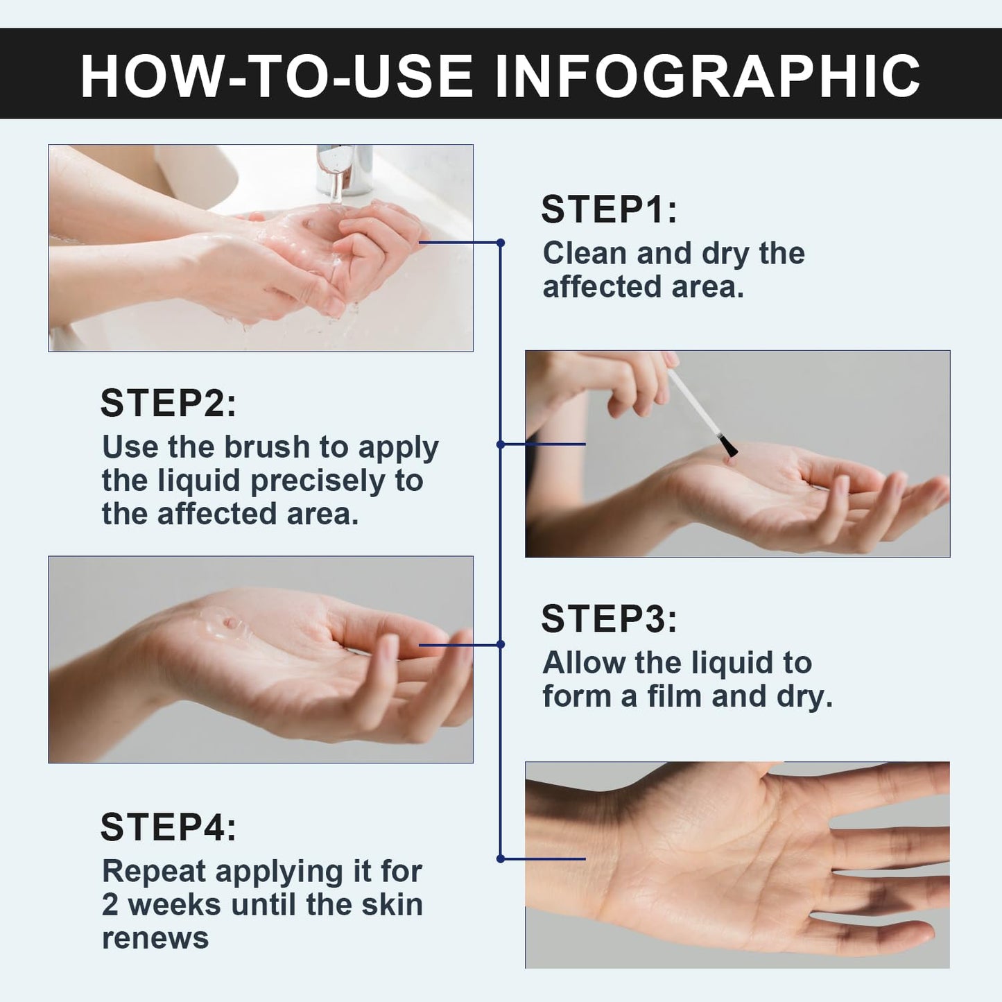 Elsophie Fast-Acting Skin Tag Removal Freeze Away – Maximum Strength Salicylic, All-in-One 30 ml