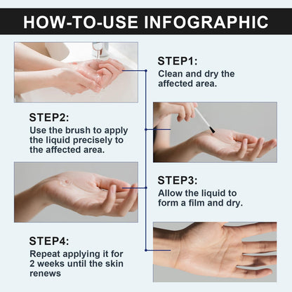 Elsophie Fast-Acting Skin Tag Removal Freeze Away – Maximum Strength Salicylic, All-in-One 30 ml