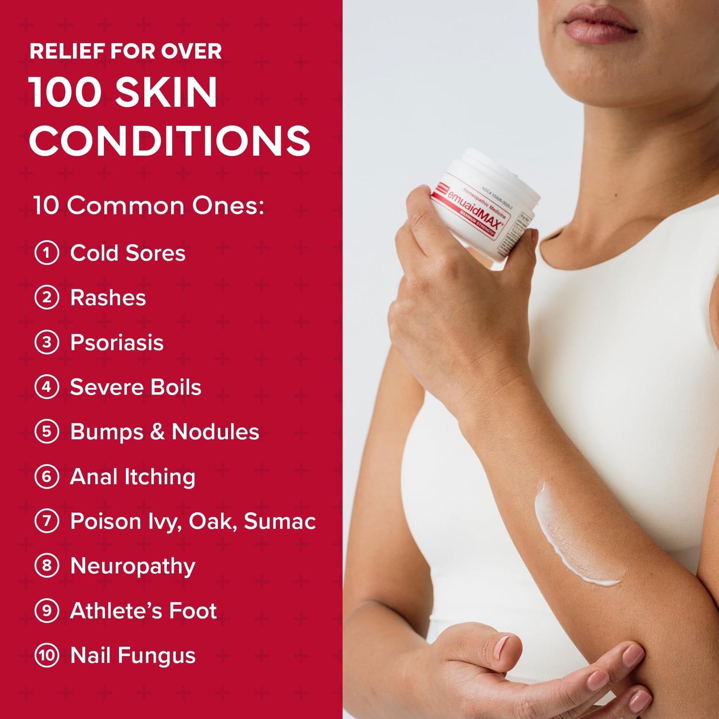 EMUAIDMAX Eczema Ointment | Maximum-Strength Relief for Eczema, Psoriasis & Skin Irritations | emuaid