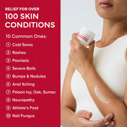 EMUAIDMAX Eczema Ointment | Maximum-Strength Relief for Eczema, Psoriasis & Skin Irritations | emuaid
