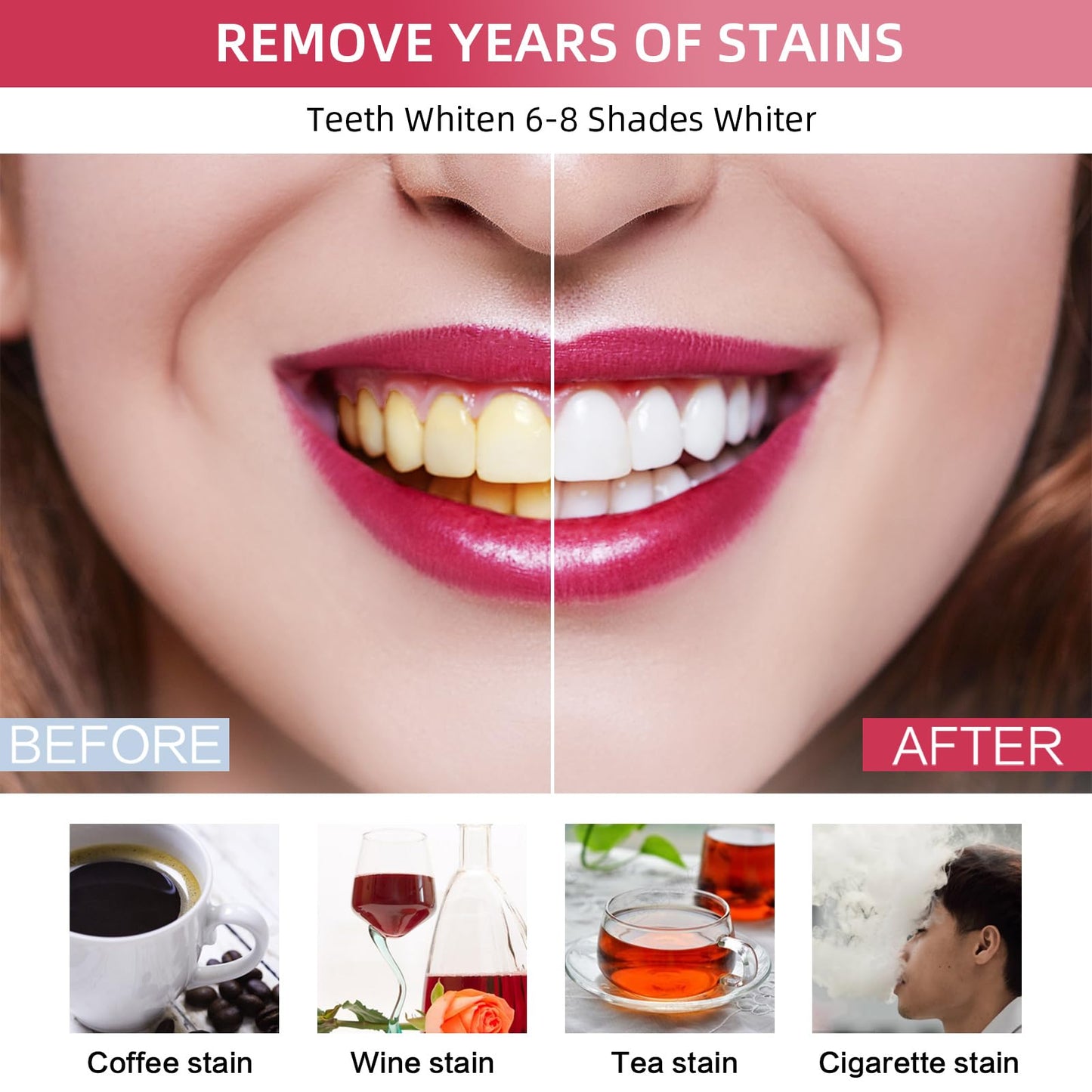 Professional Teeth Whitening Kit with 5 Gels, LED Accelerator Light & Custom Trays – Enamel Safe, Fast Home Whitening