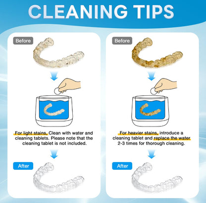 Exluvon Ultrasonic Retainer Cleaner 45kHz - 250ml Portable Ultrasonic Cleaner for Dentures, Mouth Guards, Aligners & Jewelry