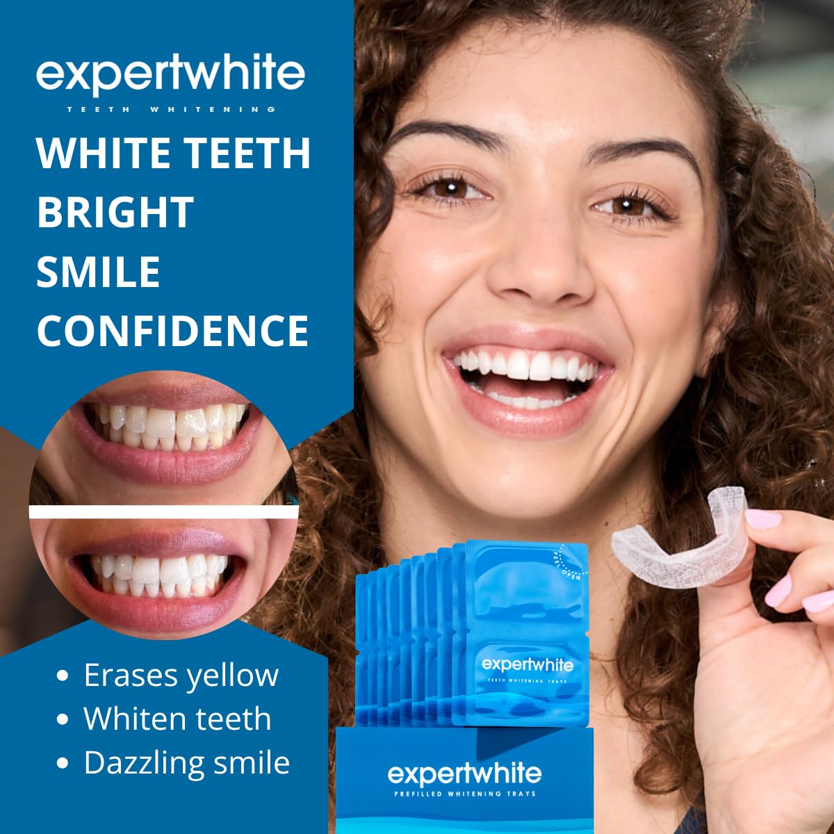 ExpertWhite Max Glow Trays – 12% Hydrogen Peroxide Teeth Whitening, 10 Treatments, Custom-Fit