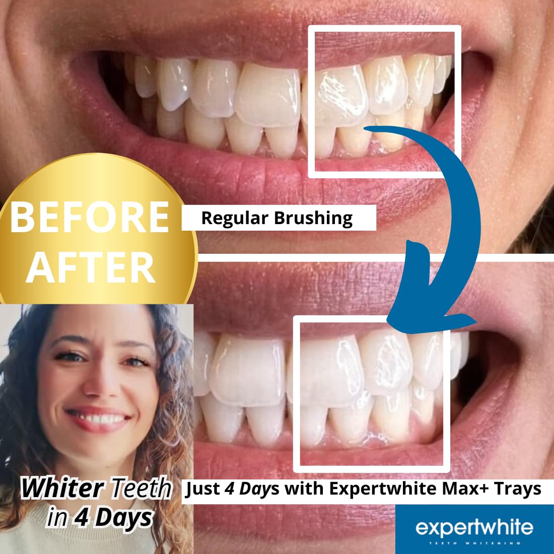 ExpertWhite Max Glow Trays – 12% Hydrogen Peroxide Teeth Whitening, 10 Treatments, Custom-Fit