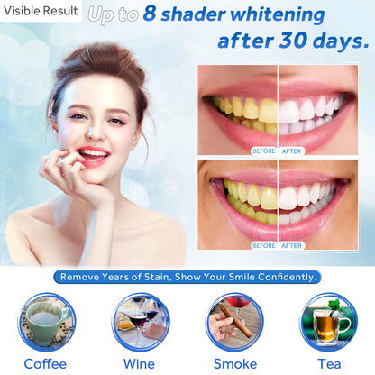 EZGO 10-Pack Teeth Whitening Gel Refills – 22% Carbamide Peroxide, Mint Flavor
