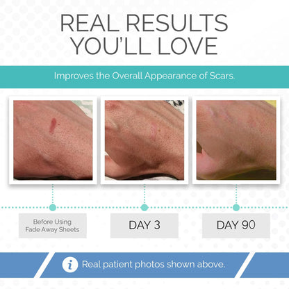 Fade Away Clinically Proven Silicone Scar Sheets – Medical Grade Tape for Surgery, C-Section, Keloids & Tummy Tuck Scars