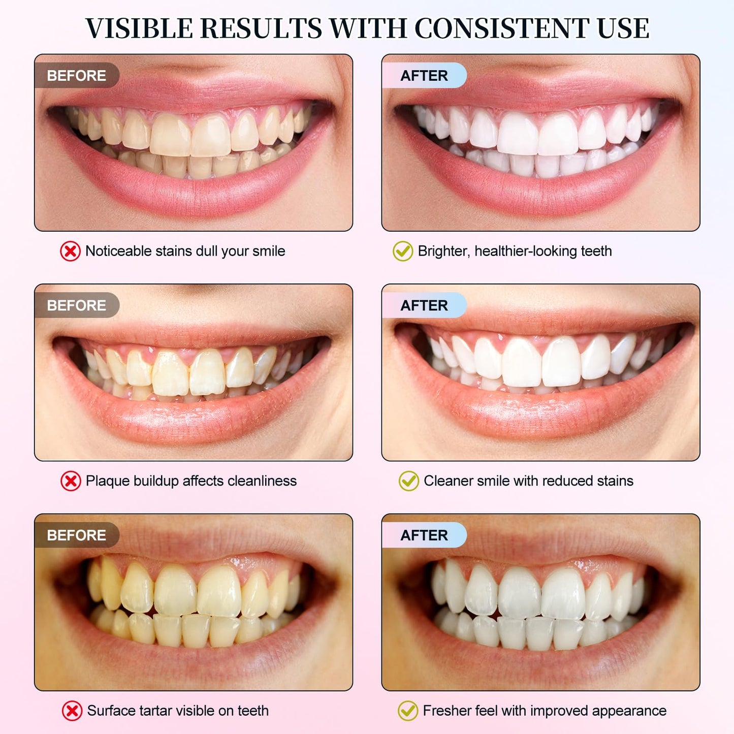 Niacinamide Whitening Toothpaste 3.5oz – Stain Removal & Enamel Protection