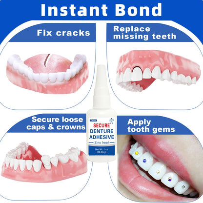 Dental Lab Instant Bonding Dental Glue (1 oz) – Denture Repair, Secure Loose or Broken Teeth, Clear, Non-Irritating Odor