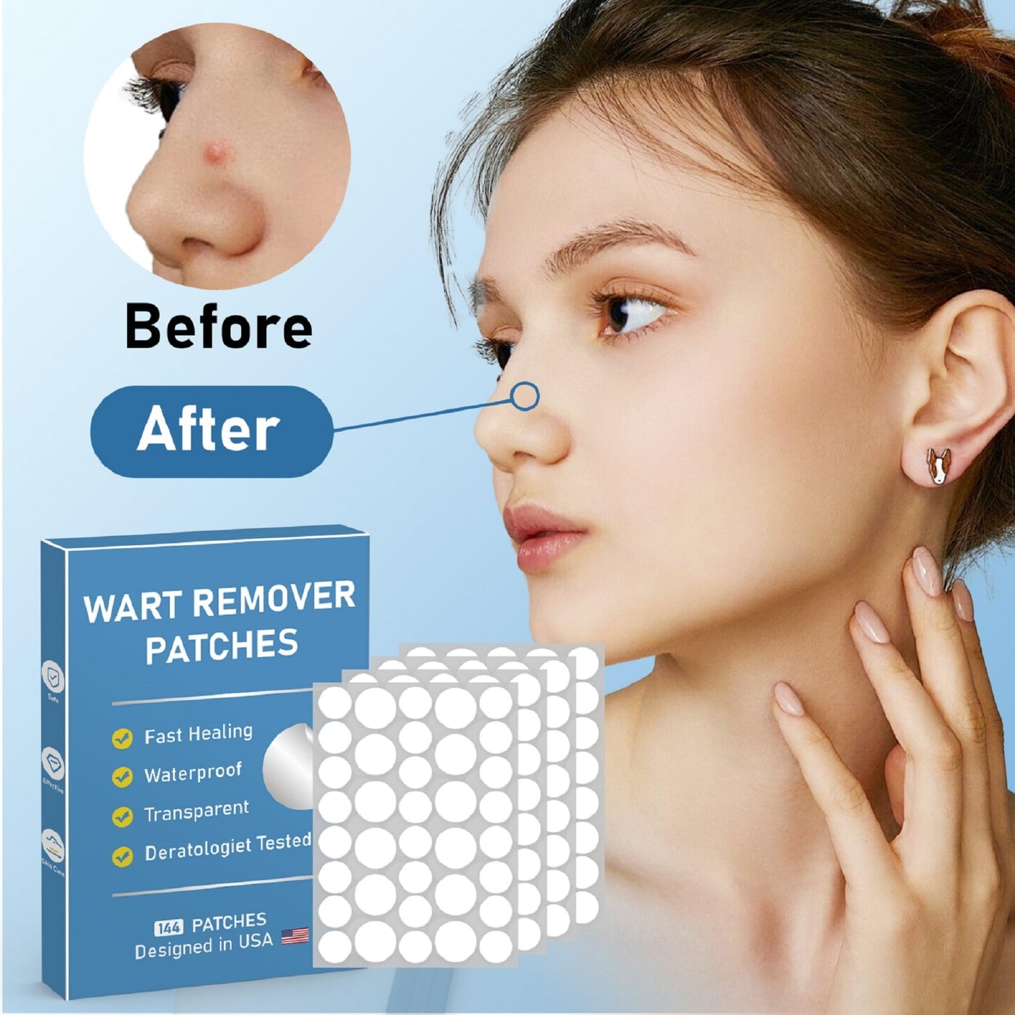 FEDOLOY Wart Remover Patches - Quick, Invisible Hydrocolloid Skin Care