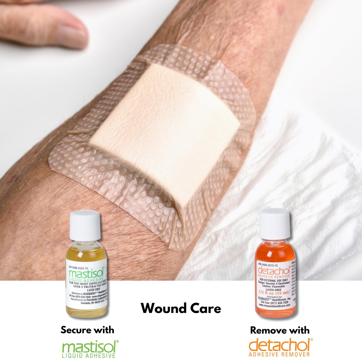 Ferndale Detachol Adhesive Remover – 4oz, Alcohol & Acetone Free, Gentle on Sensitive Skin