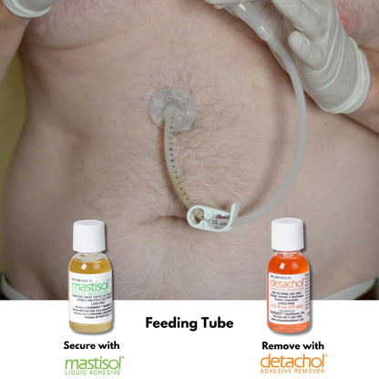 Ferndale Detachol Adhesive Remover – 4oz, Alcohol & Acetone Free, Gentle on Sensitive Skin