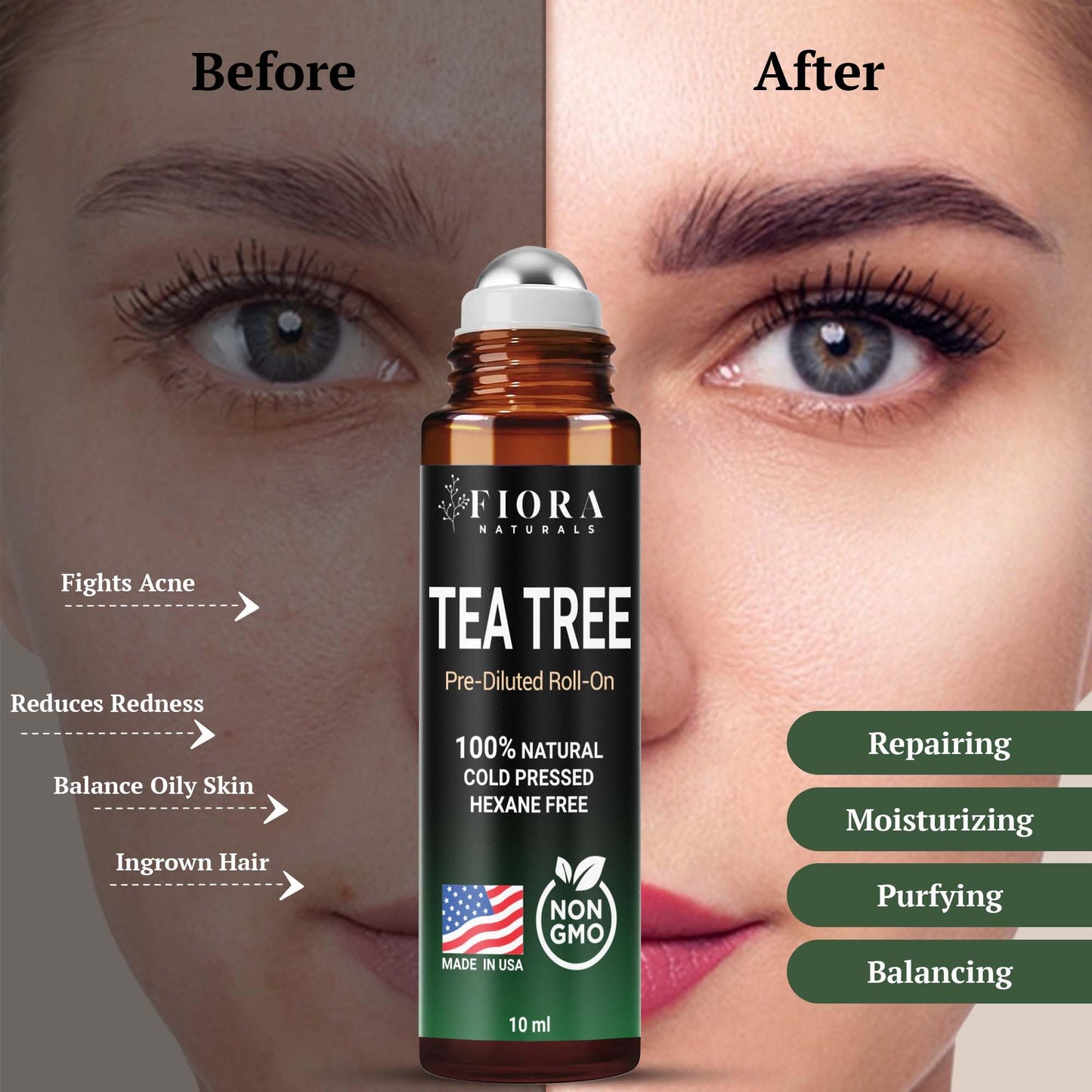 Fiora Naturals Tea Tree Oil Roll-On – 100% Natural Essential Oil for Skin, Acne & Aromatherapy