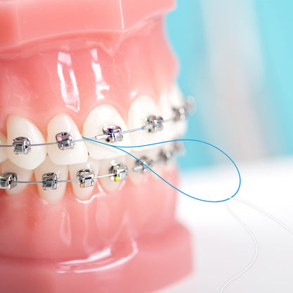 Floss Threaders for Braces, Bridges & Implants – Deep Clean 200PCS (4 Pack) Blue