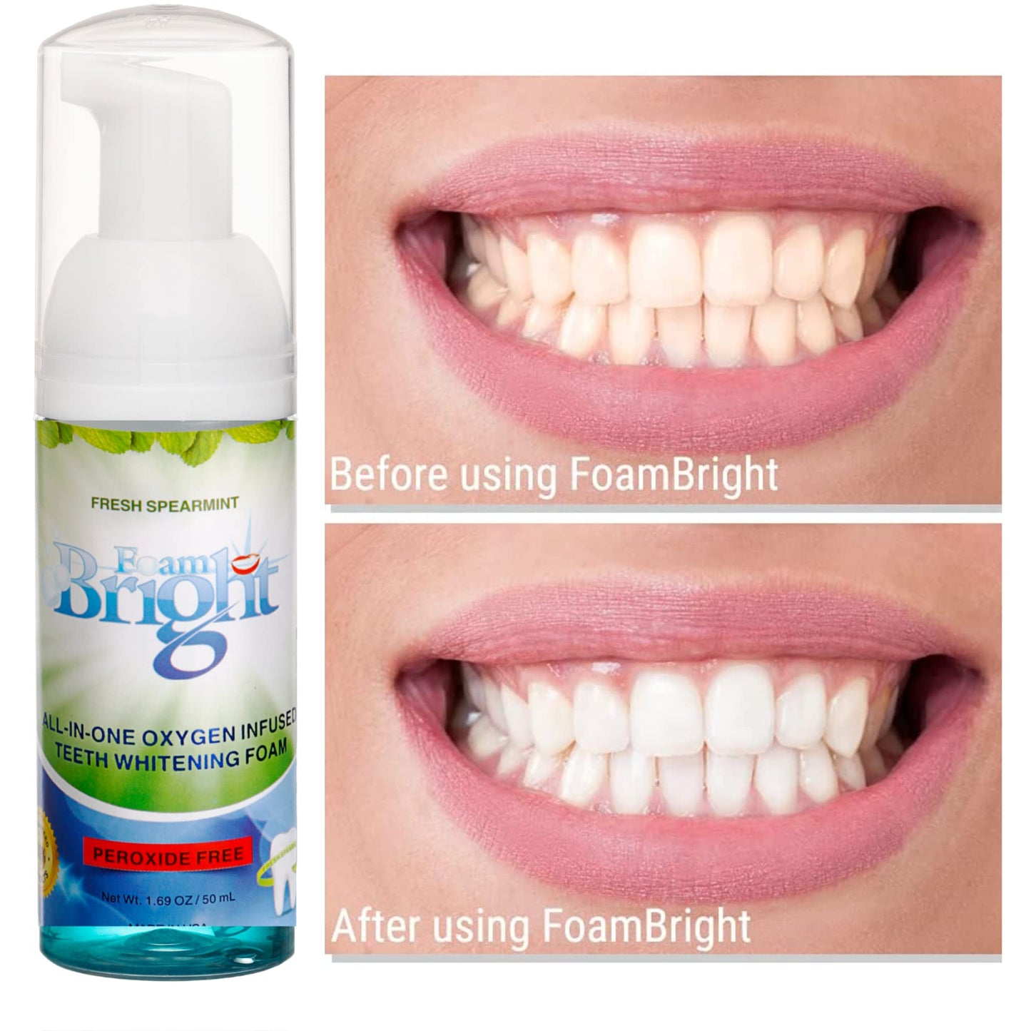FoamBright Retainer & Aligner Cleaner Foam – Peroxide-Free Oral Care for Invisalign, Braces, and Teeth Whitening
