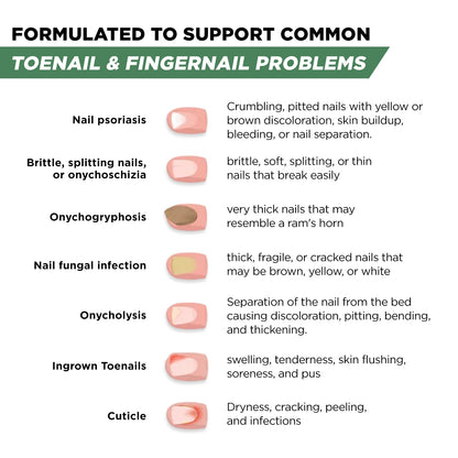 Foot Cure Toenail Fungus Treatment Extra Strength – Athletes Foot & Damaged Nail Repair | Made in USA