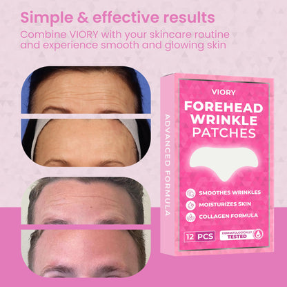 Forehead Wrinkle Patches Overnight Smoothing – Anti Wrinkle Patches for Face & Forehead | 12 pcs