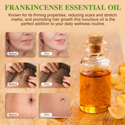 Premium Frankincense Essential Oil – 100% Pure & Natural, Therapeutic Grade for Skin, Face & Aromatherapy | Best Frankincense Oil for Face, Wrinkles & Scars | Deeply Nourishing