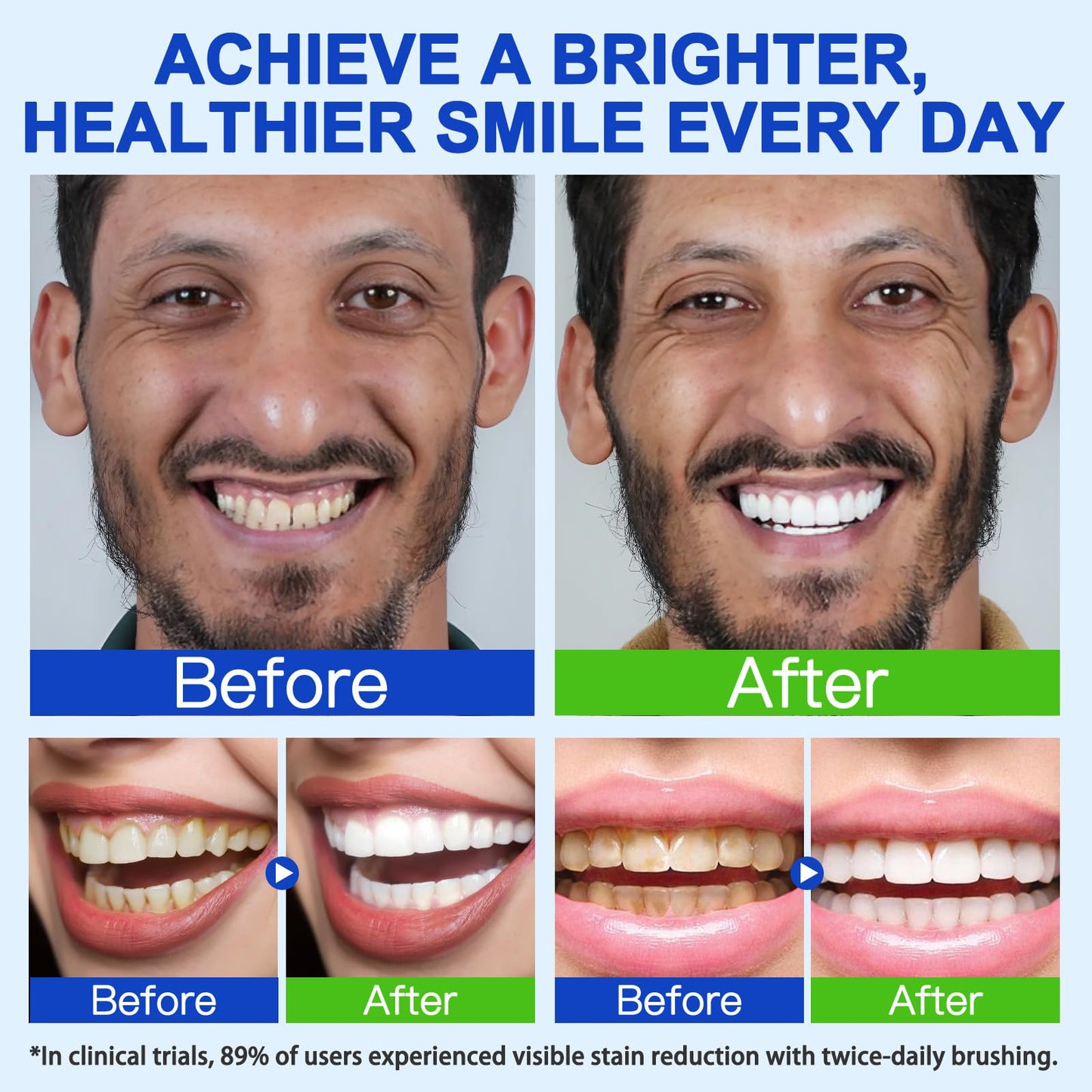 7.5% Hydroxyapatite Toothpaste for Enamel Protection, Tooth Strengthening, Gentle Mint | Fresh Breath & Daily Use
