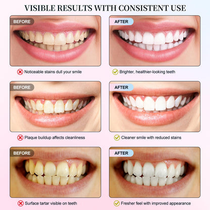 Niacinamide Whitening Toothpaste 2 Pack – Fluoride-Free, Enamel Repair & Fresh Breath