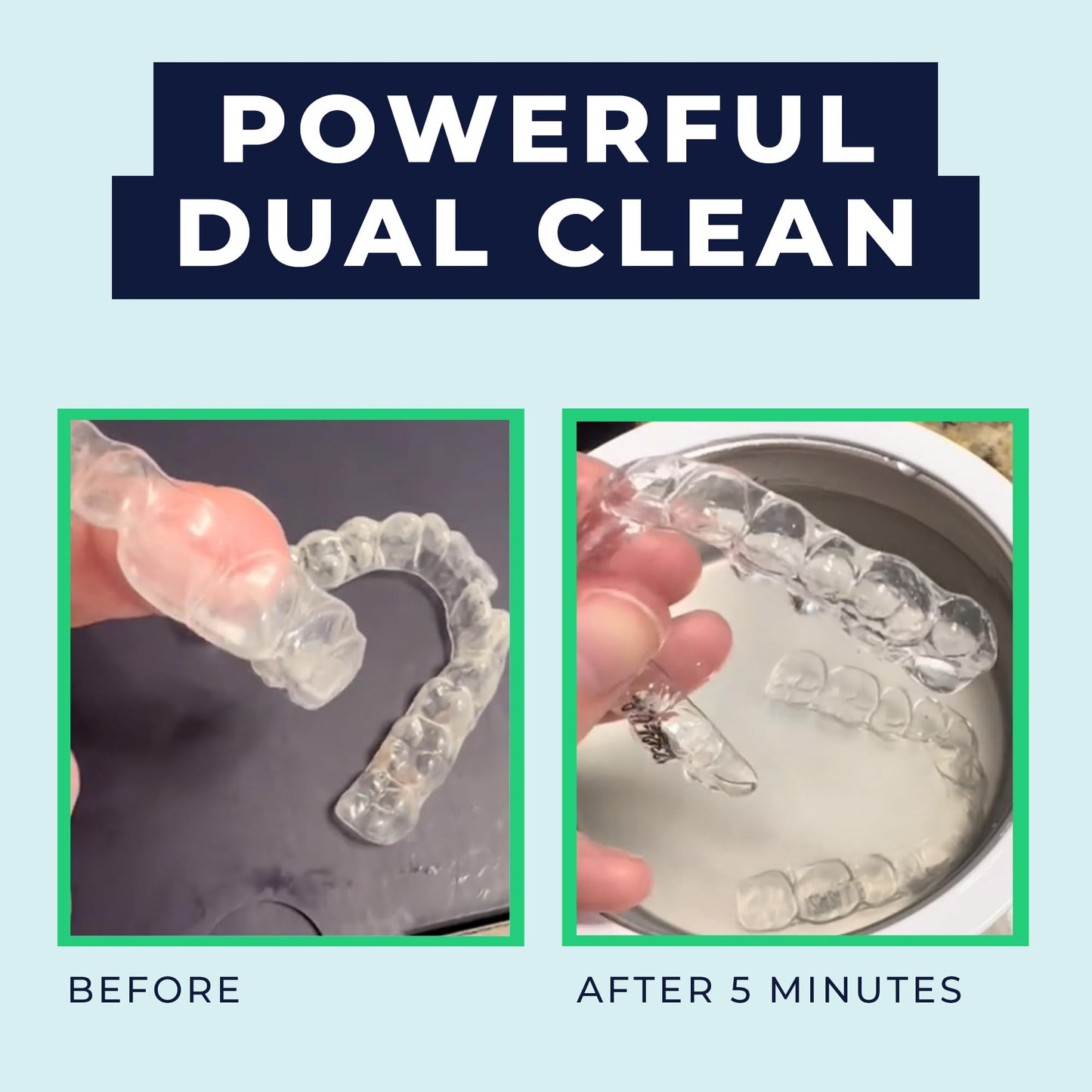 Fresh Knight Ultrasonic Retainer Cleaner – 45kHz Dental Cleaning Pod (200ml) for Dentures, Mouth Guards & Night Guards