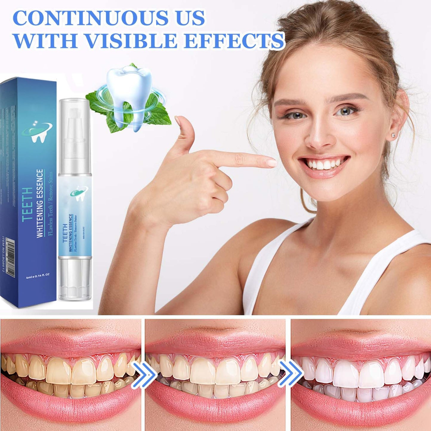 Frosty Neptune Teeth Whitening Pens & Essence (3Pcs) – Fast Stain Removal