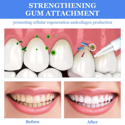 Frosty Neptune Teeth Whitening Pens & Essence (3Pcs) – Fast Stain Removal