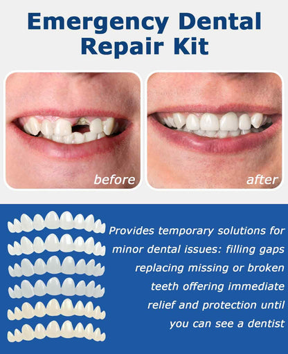 Gaahkai 12PCS Missing Tooth Replacement Kit, Temporary Moldable Thermal Beads Veneers Teeth for Filling the Gap