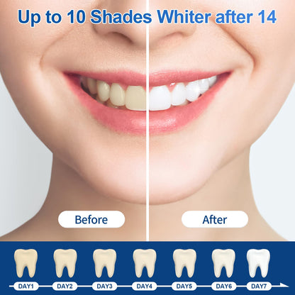 35% Ganencsnc 10-Pack Teeth Whitening Gel Refills – Gentle 35% Carbamide Peroxide Formula – Compatible with Teeth Whitening Kit, No Sensitive Teeth Whitener