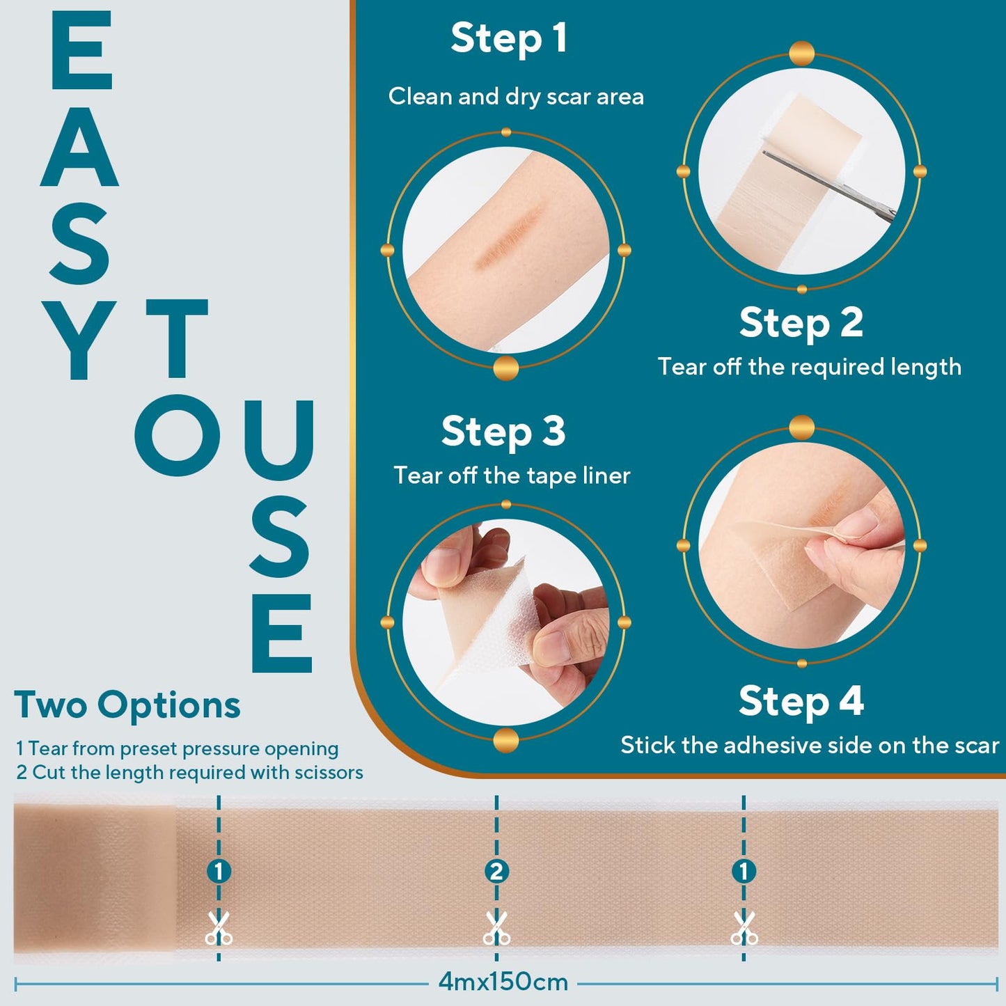 GIATENL Silicone Scar Sheets Roll – Reusable Scar Tape for Surgical Scars, Keloids, C-Section (1.5m)