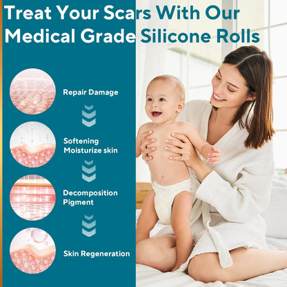 GIATENL Silicone Scar Sheets – Reusable Scar Tape for Surgical, Keloid & C-Section Scars | 1.6″ x 118″ Roll (3m)