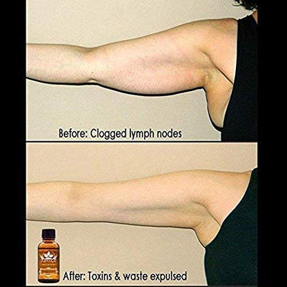 3-Pack Ginger Oil for Lymphatic Drainage – Promote Blood Circulation & Metabolism | SPA Massage Oil