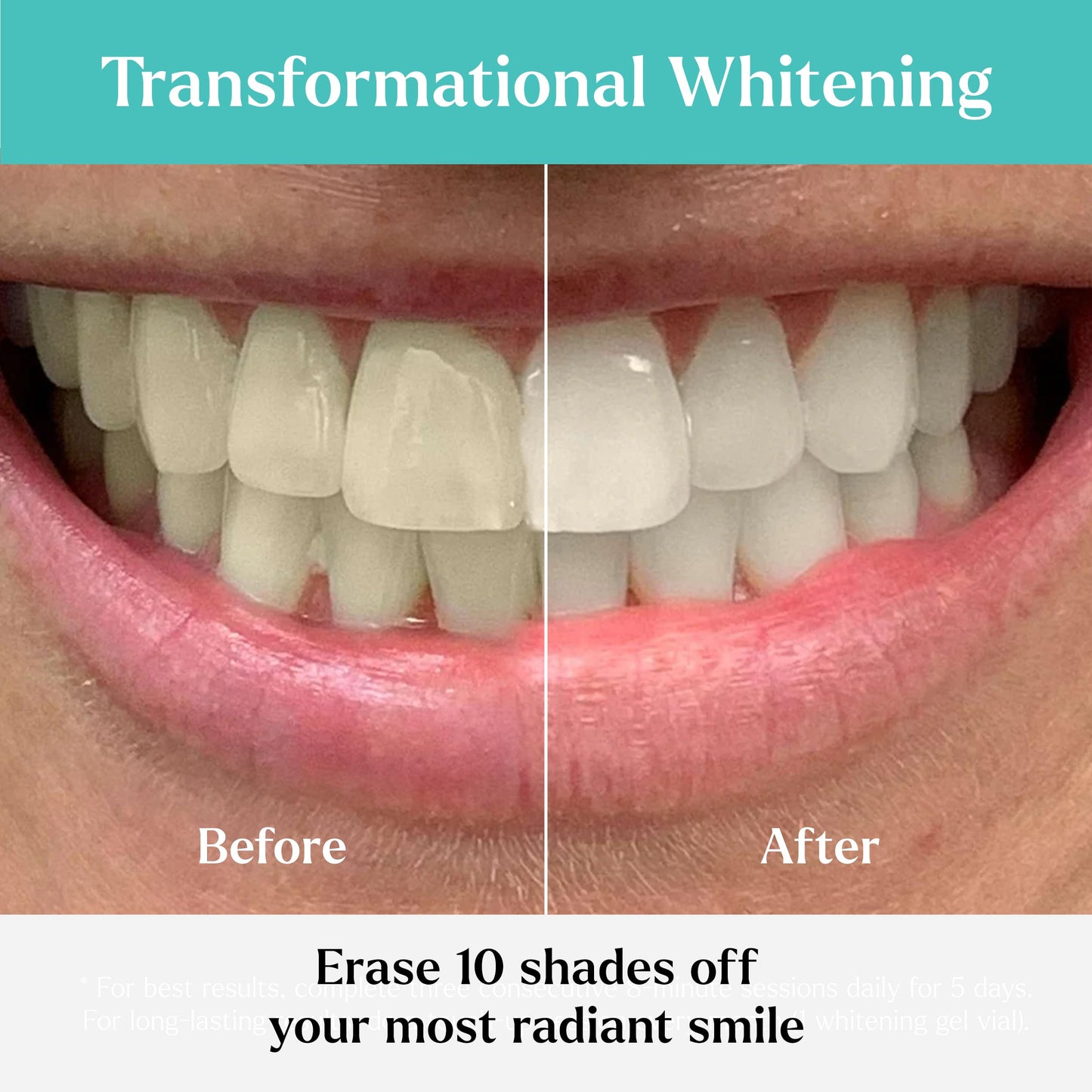 GLO Science So Brilliant Teeth Whitening Kit – Patented Warming Mouthpiece, LED Light Technology, 6% Hydrogen Peroxide Gel, Lip Balm
