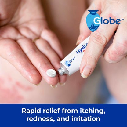 Globe (4 Pack) Hydrocortisone 1% Cream with Aloe | Instant Itch Relief