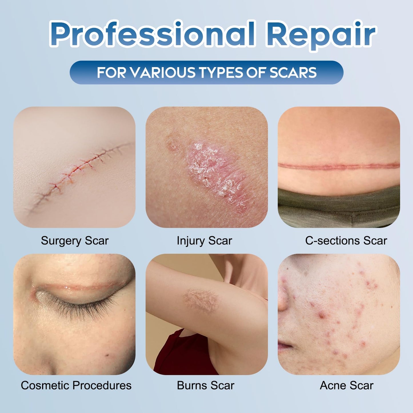 Glowor Advanced Silicone Scar Gel – Face & Body Scar Cream (3.53 oz)