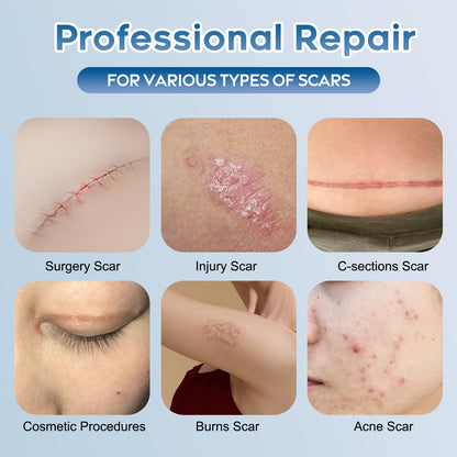 Glowor Advanced Silicone Scar Gel – Face & Body Scar Cream (3.53 oz)
